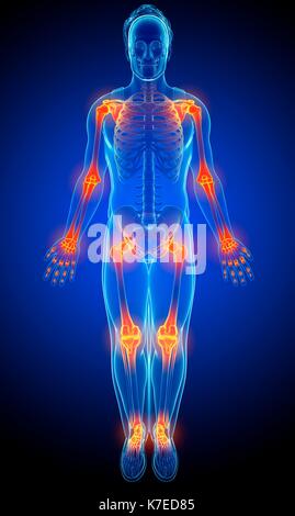 Illustration of male joint pain. Stock Photo