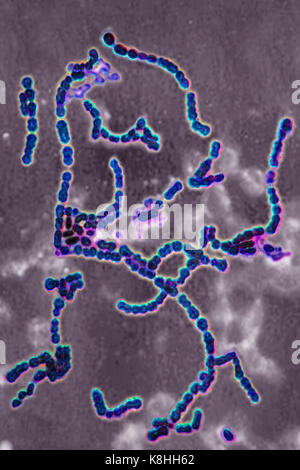 STREPTOCOCCUS PYOGENES Stock Photo