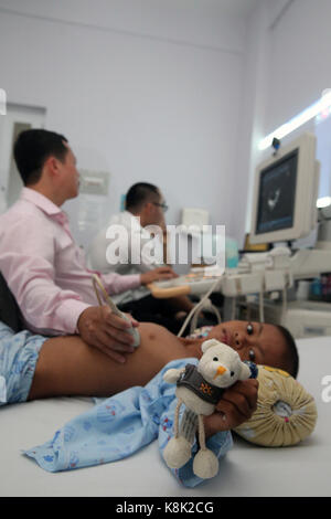 Tam duc heart hospital. doppler echocardiogram. ho chi minh city. vietnam. Stock Photo