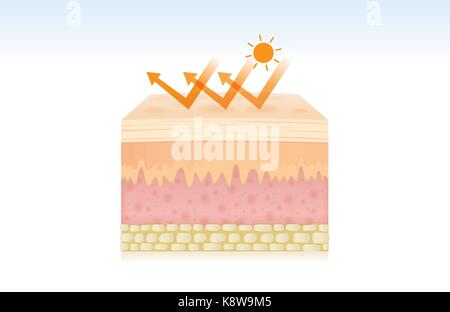 Sun exposure concept. UVA and UVB rays penetrates into dermis and ...