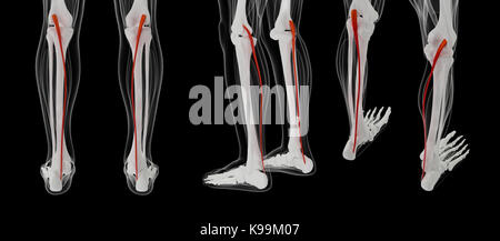 3d rendering medically accurate muscle illustration of the plantaris Stock Photo