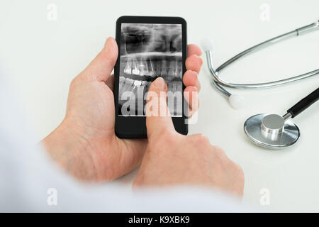 Close-up Of Person Hand With Mobile Phone Showing Dental X-ray Film Stock Photo