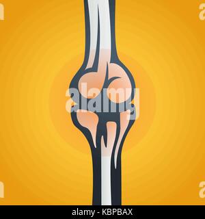 JOINT PAIN vector icon illustration Stock Vector