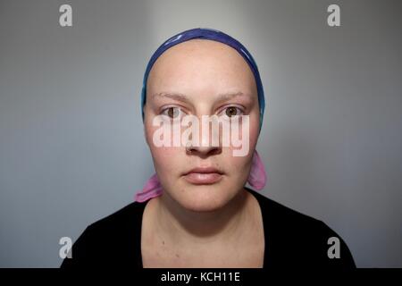 Young cancer patient in a headscarf Stock Photo