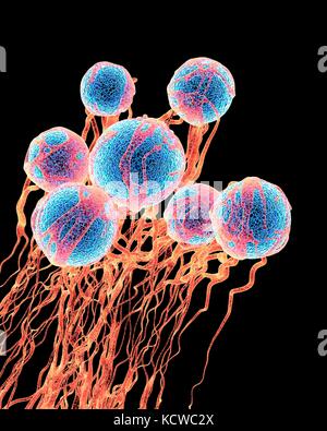 Cancer cells. Computer illustration of cancer cells, showing the blood vessel formation providing the the cells with oxygens and nutrigens. The cells with their nuclei are shown in blue. Stock Photo