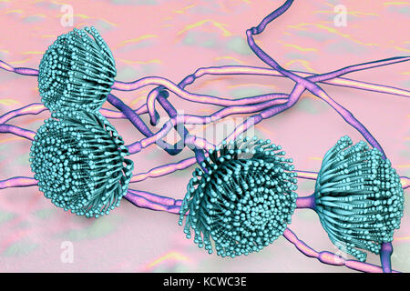 Aspergillus fungus, computer illustration. This is a toxic fungus that causes diseases in humans. These include fungal ear, lung and skin infections (lobomycosis, pulmonary aspergillosis, and mycotic keratitis). It also produces aflatoxin, one of the most powerful naturally occurring carcinogens. This can cause cancers and disorders of the lung, liver, spleen, stomach, colon and kidney. Stock Photo