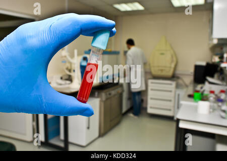 Blood test in the laboratory. A test tube with a biological sample in the hand of the laboratory assistant. Stock Photo