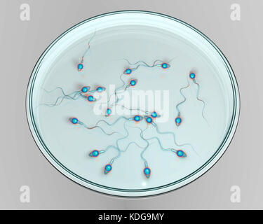 In vitro fertilization concept. Computer illustration showing spermatozoans in a petri dish waiting to be used to fertilize an egg cell. Stock Photo