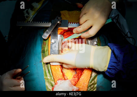 Beating human heart close-up in opened chest during the surgery chest during heart surgery Stock Photo