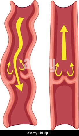 Varicose veins in human body illustration Stock Vector