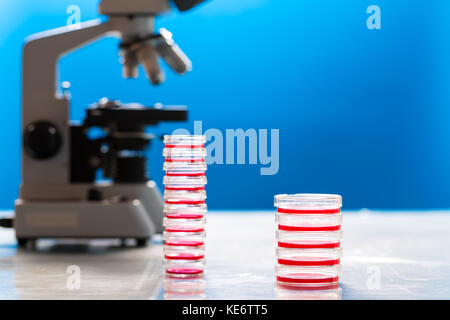 Identification of pathogenic microbes and viruses Stock Photo