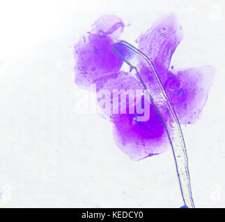 Dog cheek cells cluster through microscope, microphotograph, dyed purple, showing nuclei and cells structure Stock Photo