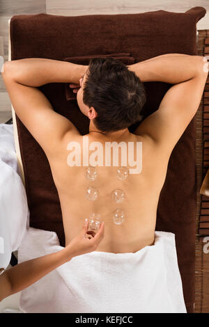 High Angle View Of A Therapist Giving Cupping Treatment To Man Stock Photo