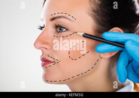 Close-up Of A Surgeon Correction Drawing Lines On Young Woman Face For Plastic Surgery Stock Photo