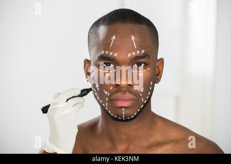 Close-up Of Person's Hand Drawing Correction Lines On African Man's Face Stock Photo