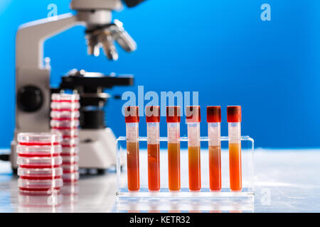 Identification of pathogenic microbes and viruses Stock Photo