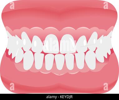 Jaw with teeth icon flat style. Open mouth, dentures. Dentistry, medicine concept. Isolated on white background. Vector illustration. Stock Vector