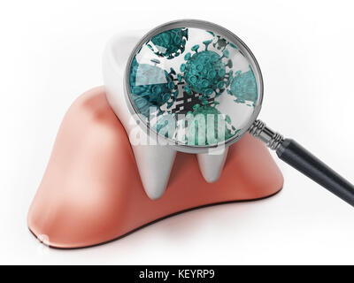 Microscopic bacteria tooth concept of a tooth with a magnifying glass ...
