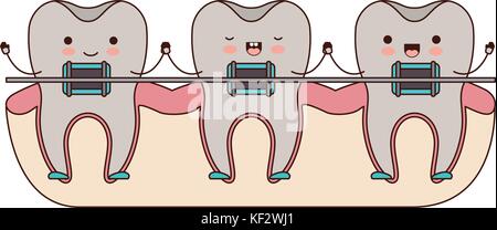Cute tooth with dental braces emoji character Stock Vector Image & Art ...