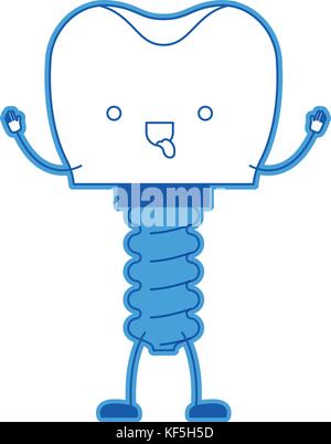 tooth implant with screw cartoon in blue silhouette Stock Vector