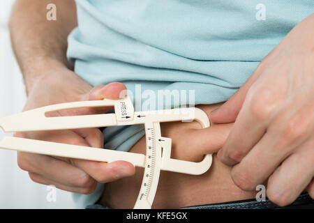 Close-up Of Man Measuring Stomach Fat With Caliper Stock Photo