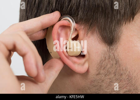 Close-up Of Man Wearing Hearing Aid In Ear Stock Photo