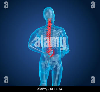 Spinal pain Attack, man suffering from spinal pain. 3D illustration Stock Photo