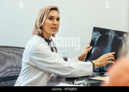 Female doctor showing diagnosis of x-ray image to patient sitting at clinic. Healthcare professional discussing health condition with patient using me Stock Photo