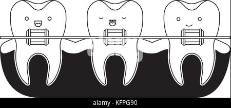 teeth kawaii with braces in black silhouette Stock Vector