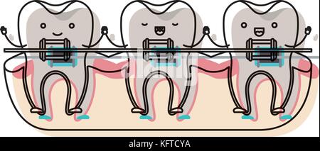 Cute tooth with dental braces emoji character Stock Vector Image & Art ...
