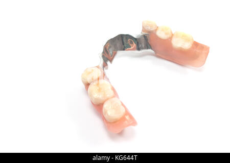 Partial denture upper side - dental prosthetics isolated on white Stock Photo