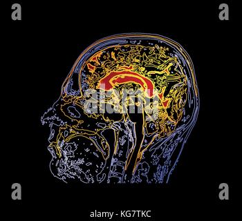 Topographic map MRI of the human brain. Stock Vector