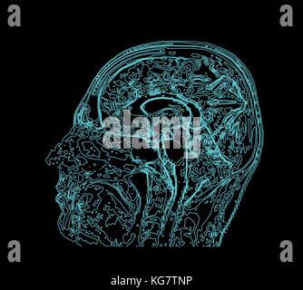 Topographic map MRI of the human brain. Stock Vector
