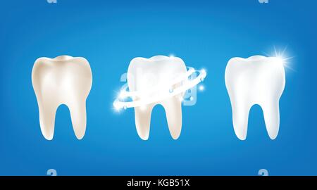 Collection of dirty clean and strong  white tooth wiht glittering bright light element on blue background vector illutration eps10 Stock Vector