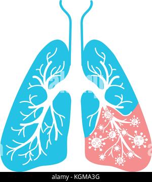 icon of lung disease, pneumonia, asthma, cancer in the form of lung anatomy and viruses, bacteria causing disease. Icon in linear style Stock Vector