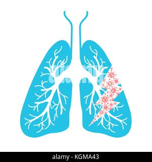 icon of lung disease, pneumonia, asthma, cancer in the form of lung anatomy and viruses causing disease. Icon in linear style Stock Vector