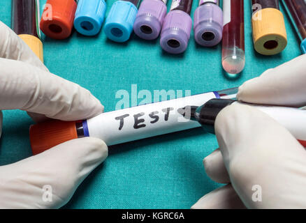 Vials and blood samples in a hospital tray, conceptual image Stock Photo