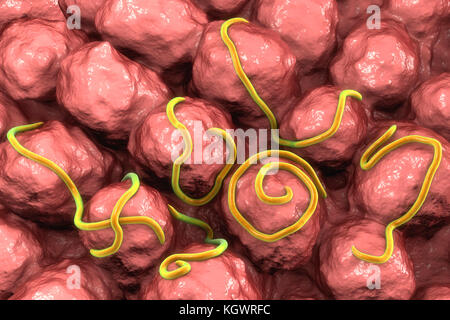 Threadworms in the gut. Computer illustration showing multiple threadworms (Enterobius sp.) on the interior of a human intestine. Threadworms are nematode worms that parasitize the large intestine and caecum of many animals. In humans they cause the common infection enterobiasis. Nematodes are unsegmented worms that may be parasitic or free-living depending upon the species. Stock Photo