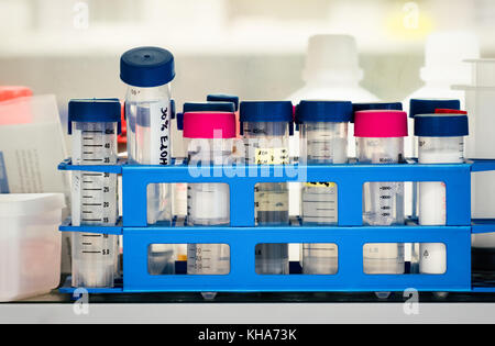 Plastic test tubes in plastic stand Stock Photo