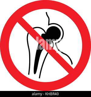 No access for people with metallic implants. No metallic implants area, prohibition sign, vector illustration. Stock Vector
