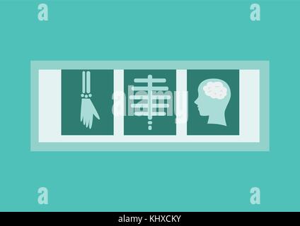 X-ray films in flat style. Vector Illustration Stock Vector