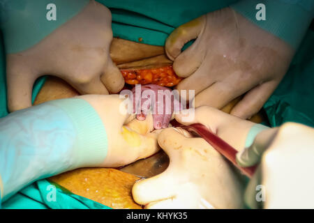 Newborn baby holding on to doctor's hand while in hospital a few min during being born. Stock Photo