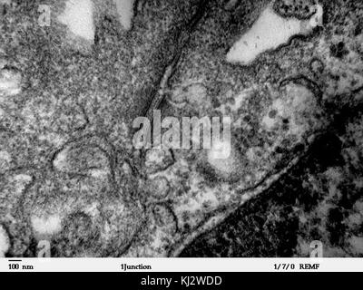 Desmosome - epithelial cell from mammalian lung tissue - TEM Stock Photo