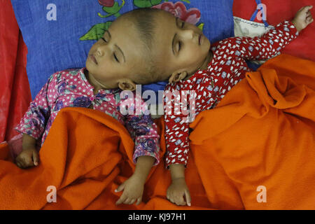 Dhaka, Bangladesh. 22nd Nov, 2017. Rabeya and Rokeya, 18 month old sister who born conjoined at head sleeping at the Dhaka Medical College Hospital (DMCH).The twins are offspring of Rafiqul Islam and Taslima Khatun from Atlongka village in Pabna's Chatmohar . Twins father Rafiqul Islam says, they have been admitted to the burn unit at the Dhaka Medical College Hospital for examination before surgery to separate their heads. Credit: Md. Mehedi Hasan/ZUMA Wire/Alamy Live News Stock Photo