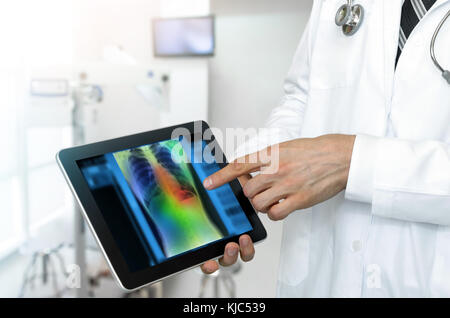 Artificial intelligence in smart healthcare hospital technology concept. Professional doctor use AI algorithm and machine learning detect Pneumonia an Stock Photo