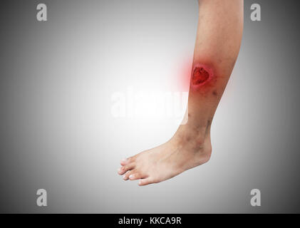 Injured leg with blood isolated on white Stock Photo - Alamy