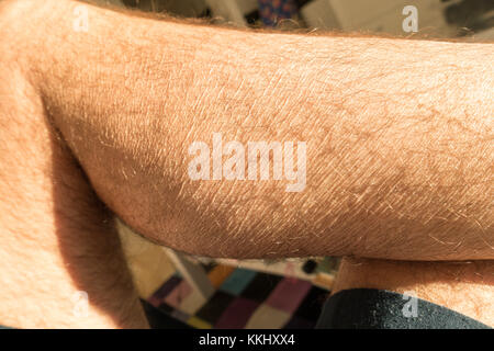 Close up of senior mans hairy leg showing prominent skin wrinkles Stock Photo