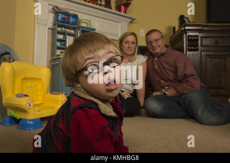 Suwanee, GA, USA. 15th Jan, 2018. Zach Ehlers, 2, has Dpwn syndrome and required eye surgery for cataracts. He has developmental challenges typical of Trisomy 21, the genetic name for the chromosome abnormality. It is a genetic disorder caused by the presence of all or part of a third copy of chromosome and is typically associated with physical growth delays, characteristic facial features and mild to moderate intellectual disability. The average IQ of a young adult with Down syndrome is 50, equivalent to the mental ability of an 8- or 9-year-old child, but this can vary widely.Pictured: Zac Stock Photo