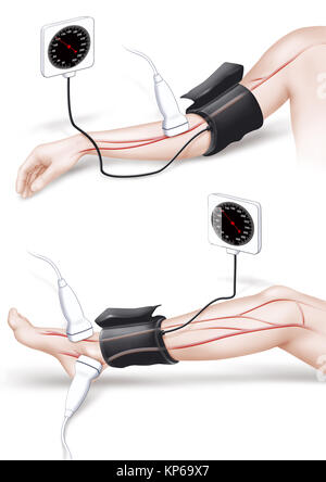 ARTERIAL PRESSURE, ILLUSTRATION Stock Photo