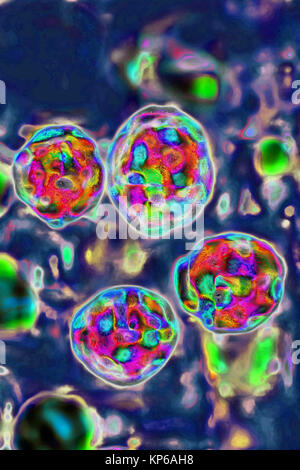 The measles virus (paramyxoviridae from the Morbillivirus family). Image taken from a transmission microscopy view. Stock Photo